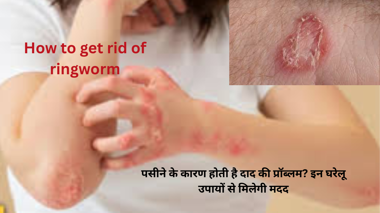 पसीने की वजह से स्किन पर दाद (ringworm) की समस्या से जूझती महिला